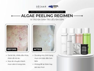 Review Peel Da với Sản Phẩm Décaar: Trải Nghiệm Peel Sinh Học Tại Nhà
