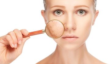 Phương pháp điều trị da nên hay không nên làm sát Tết