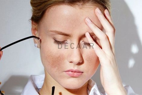 Nám Kháng Trị Là Gì? Cách Điều Trị Nám Kháng Trị Hiệu Quả