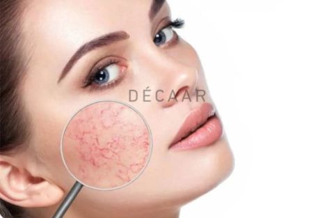 Bật Mí Cách Phục Hồi Da Mỏng Yếu Tại Nhà Hiệu Quả, Nhanh Chóng