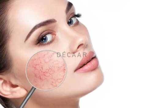 Peel Da Có Làm Da Yếu Đi Không