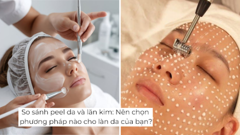  So sánh peel da và lăn kim: Nên chọn phương pháp nào cho làn da của bạn?