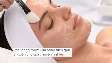 Peel da trị mụn: Giải pháp hiệu quả, an toàn cho spa chuyên nghiệp