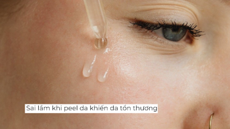 Sai lầm khi peel da khiến da tổn thương