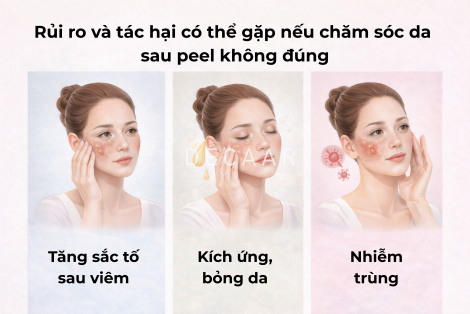 Chăm sóc da sau peel da trị nám giữ da sáng lâu và an toàn