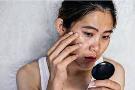 Vì Sao Da Xỉn Màu Và Kém Căng Bóng Rõ Rệt Sau Tết Dù Skincare Không Đổi?