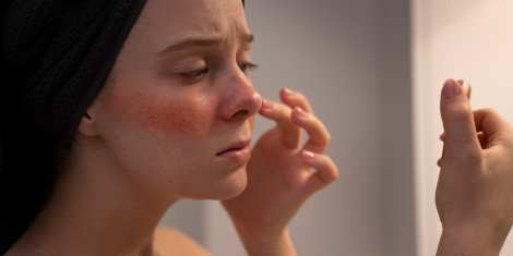 Vì sao da nhạy cảm hơn khi giao mùa