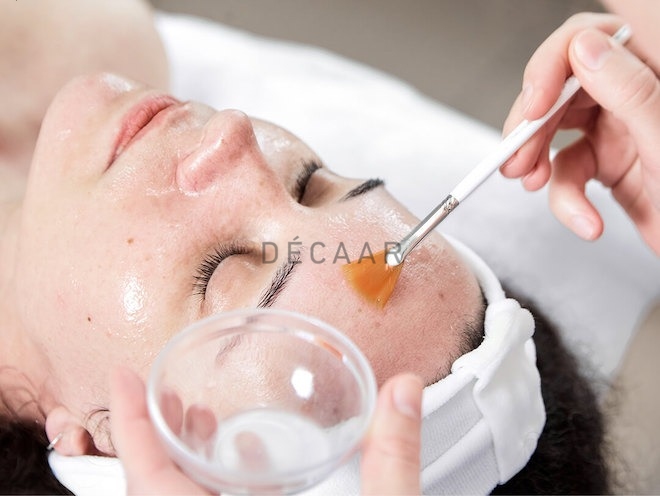 acid peel