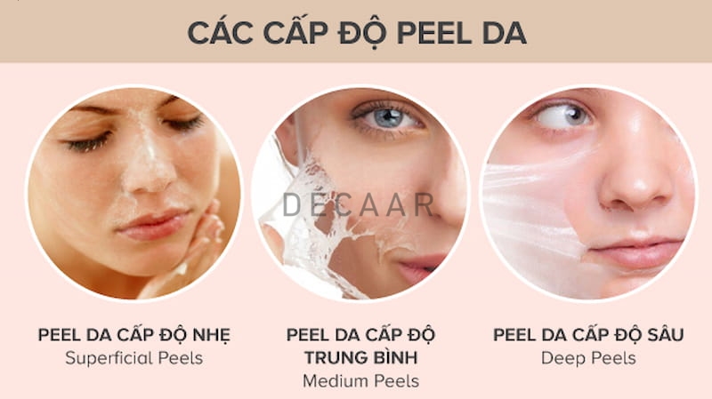 acid peel