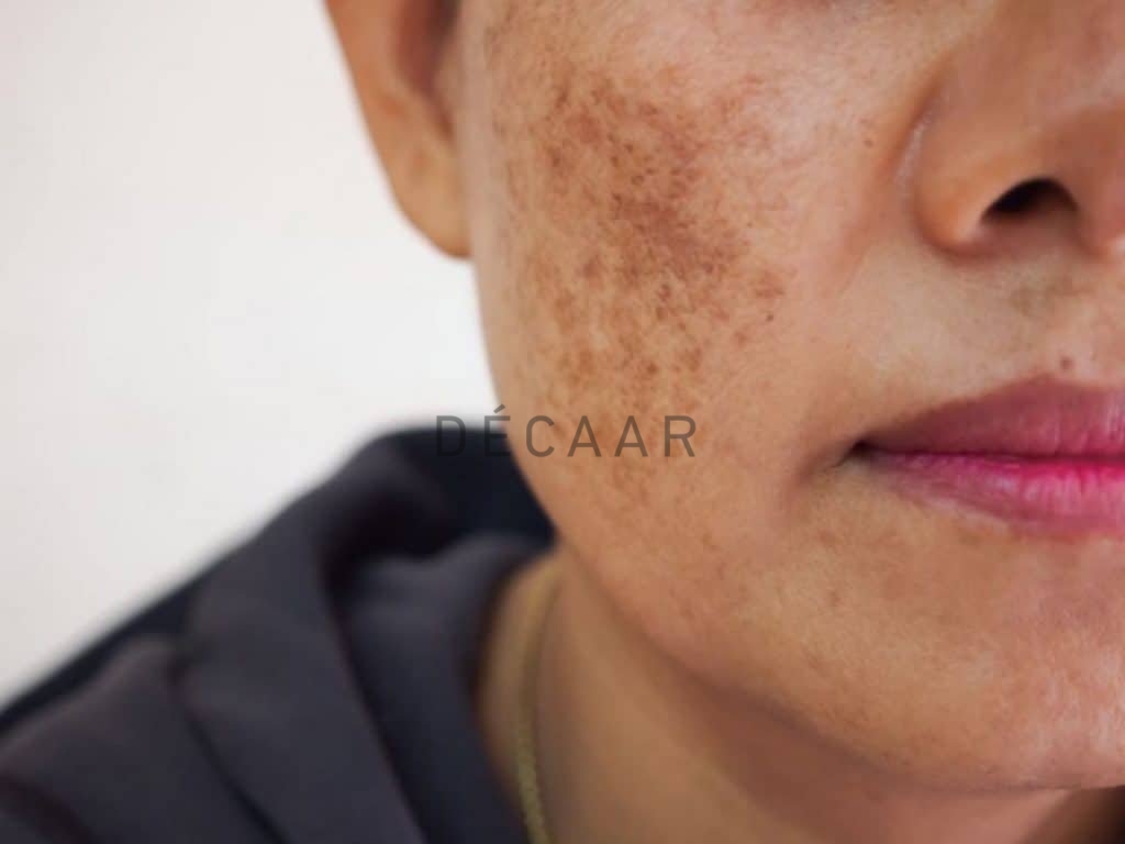biến chứng sau peel da