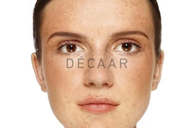 sắc tố melanin