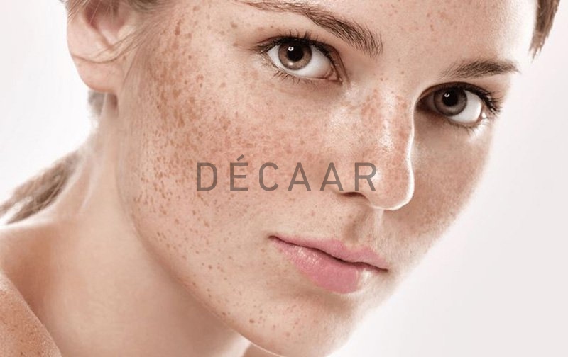 sắc tố melanin