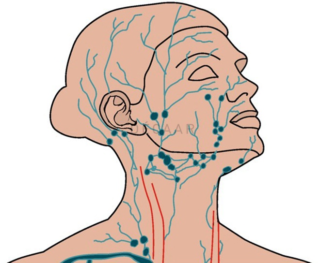thải độc hệ bạch huyết